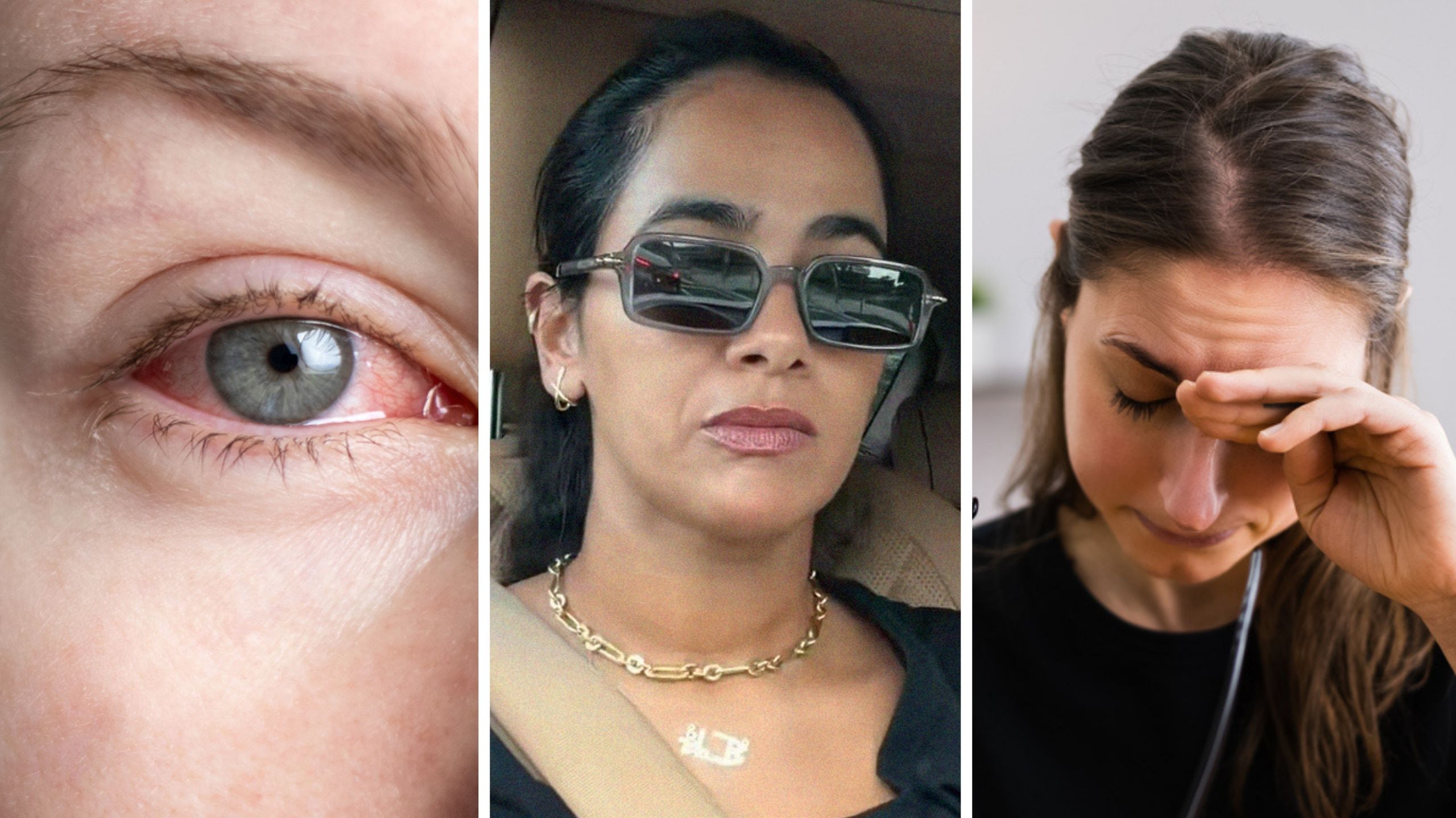 red eyes (l) Eye Surgeon Shares How To Properly Rub Your Eyes (c) woman rubbing her eyes (r)