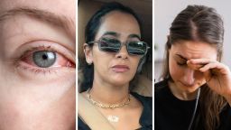 Eye Surgeon Shares How To Properly Run Your Eyes—You’re Probably Giving Yourself Keratoconus