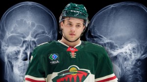 Minnesota Wild defenseman Brock Faber over skull X-rays