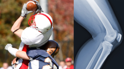Iowa Football Player’s Dad Rips Rival Coaches For ‘Illegal’ Tackle That Caused Season-Ending Injury