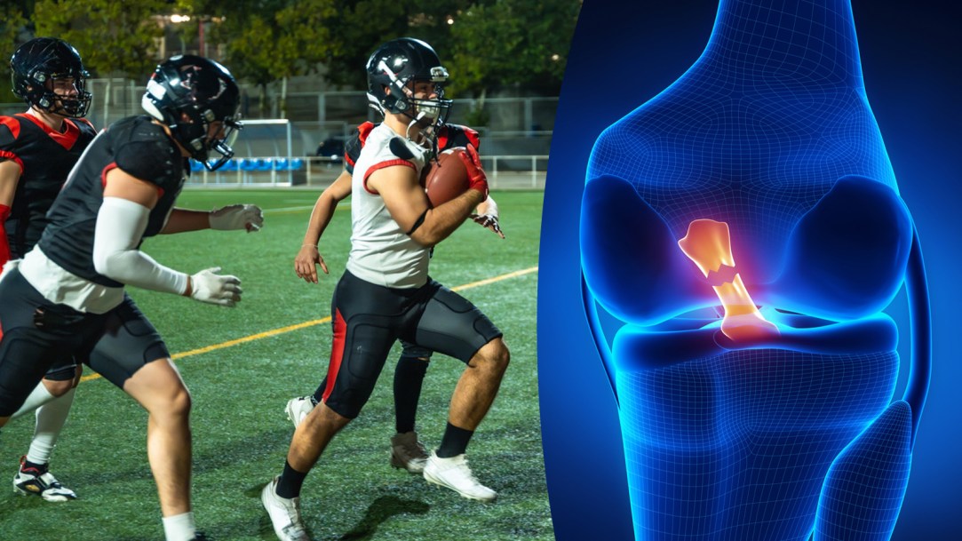 high school football torn acl late hit out of bounds california