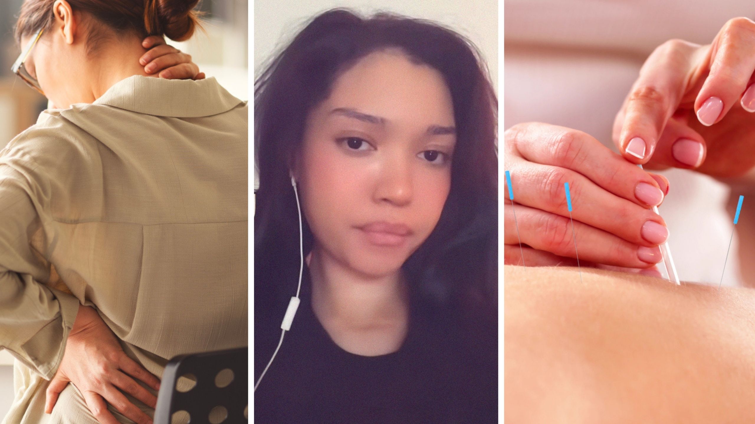 woman with neck pain (l) woman shares Acupuncture experience (c) woman getting Acupuncture (r)